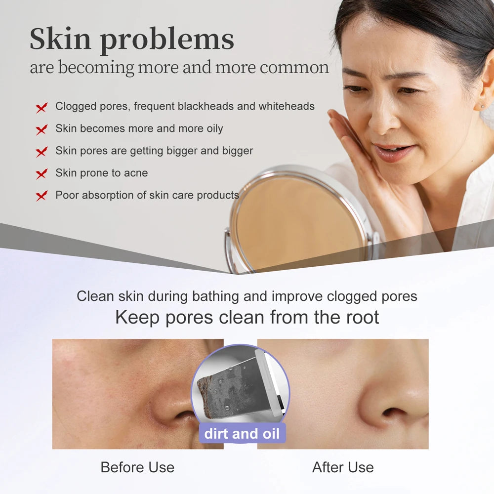 ANLAN Ultrasonic Skin Scrubber