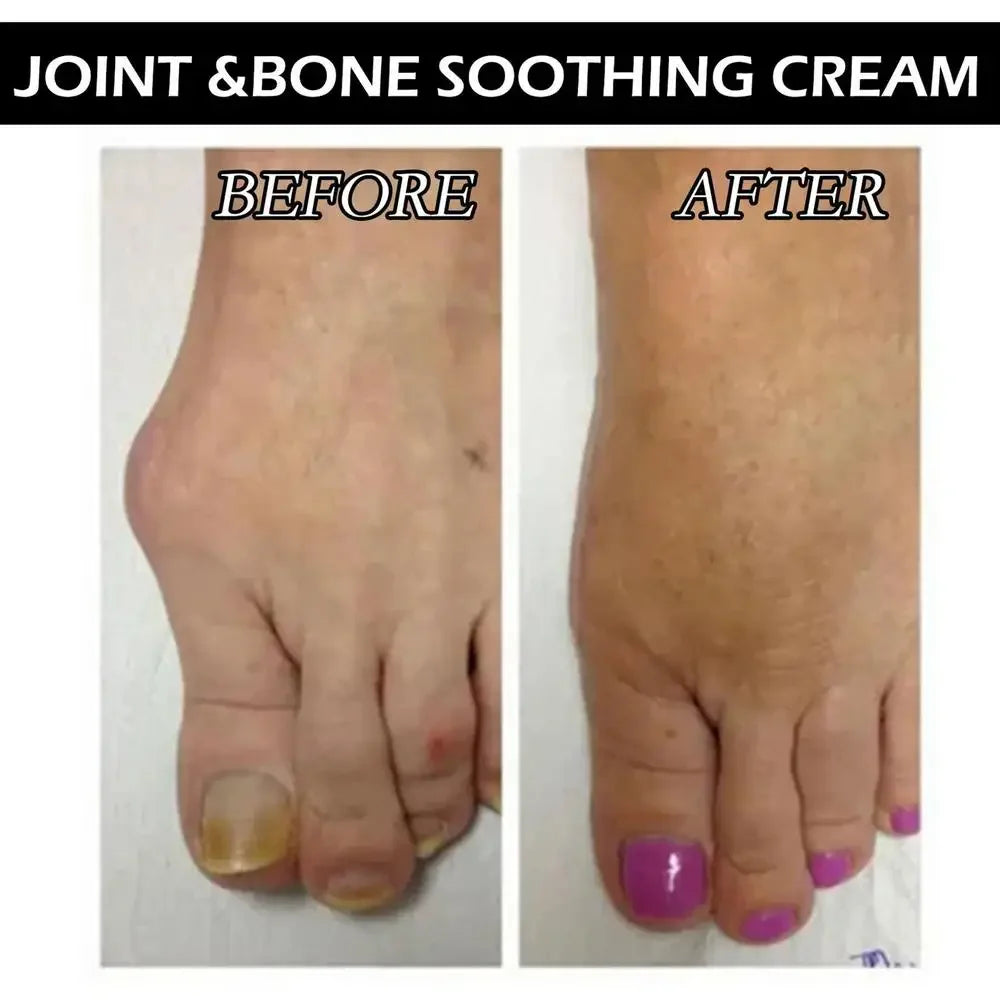 Joint Bone Counterpain Cream